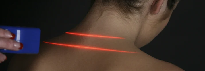 A therapeutic procedure using a handheld device emitting red laser beams directed at the upper back or neck area, indicating a treatment such as cold laser therapy.